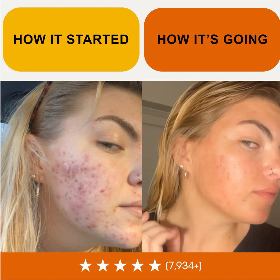 Skin Calm & Balance Ritual